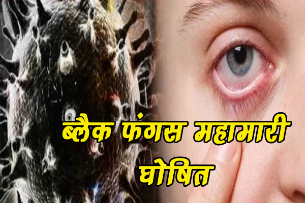 हिमाचल में अब ब्लैक फंगस महामारी घोषित