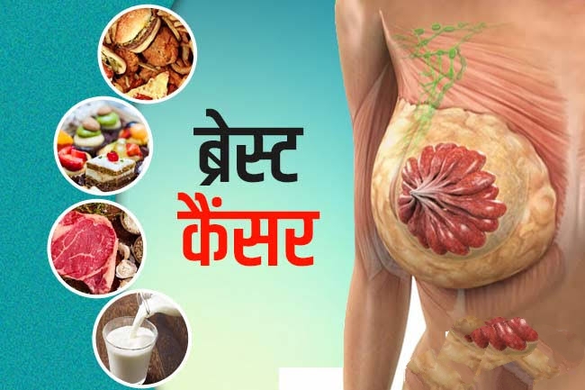 ब्रेस्ट कैंसर का आईजीएमसी में लगेगा मुफ्त इंजेक्शन