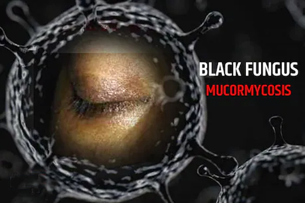 ब्लैक फंगस