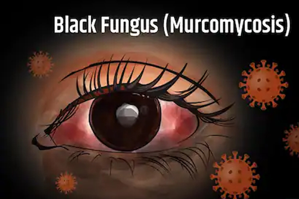 black-fungus- case-in-himacha