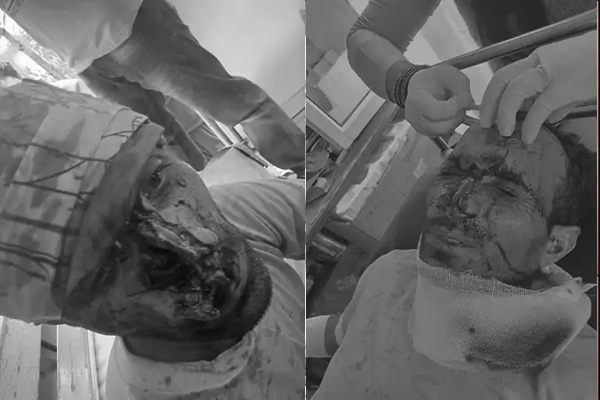 नेरवा में भालुओं ने दो लोगों को किया लहूलुहान