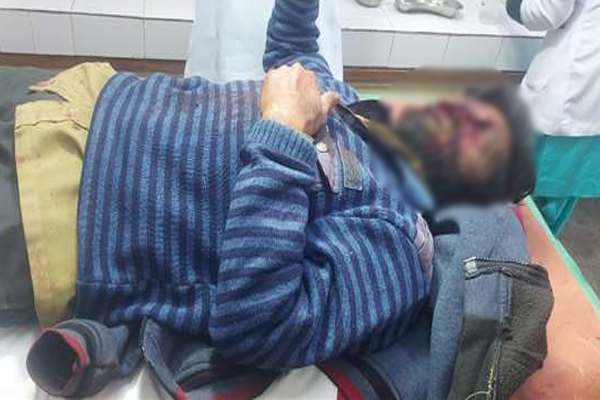 वन विभाग में माली पर भालू का हमला, 15 मिनट लड़कर बचाई जान