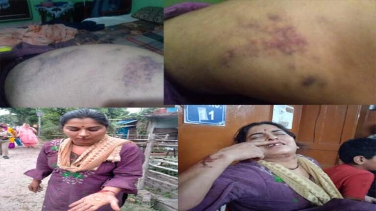 नगरोटा बगवां: महिला ने पति और सास पर प्रताड़ना के आरोप, सोशल मीडिया में वायरल हुआ वीडियो