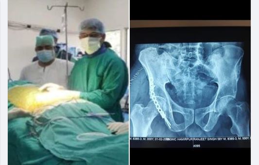 मेडिकल कालेज हमीरपुर के ऑरथोपैडिक सर्जरी विभाग की टीम ने की दुर्लभ एवं जटिल सर्जरी