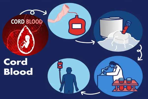 Umbilical Cord Blood: जानिए! दुनिया भर में क्यों बढ़ रहा है इसका चलन ?