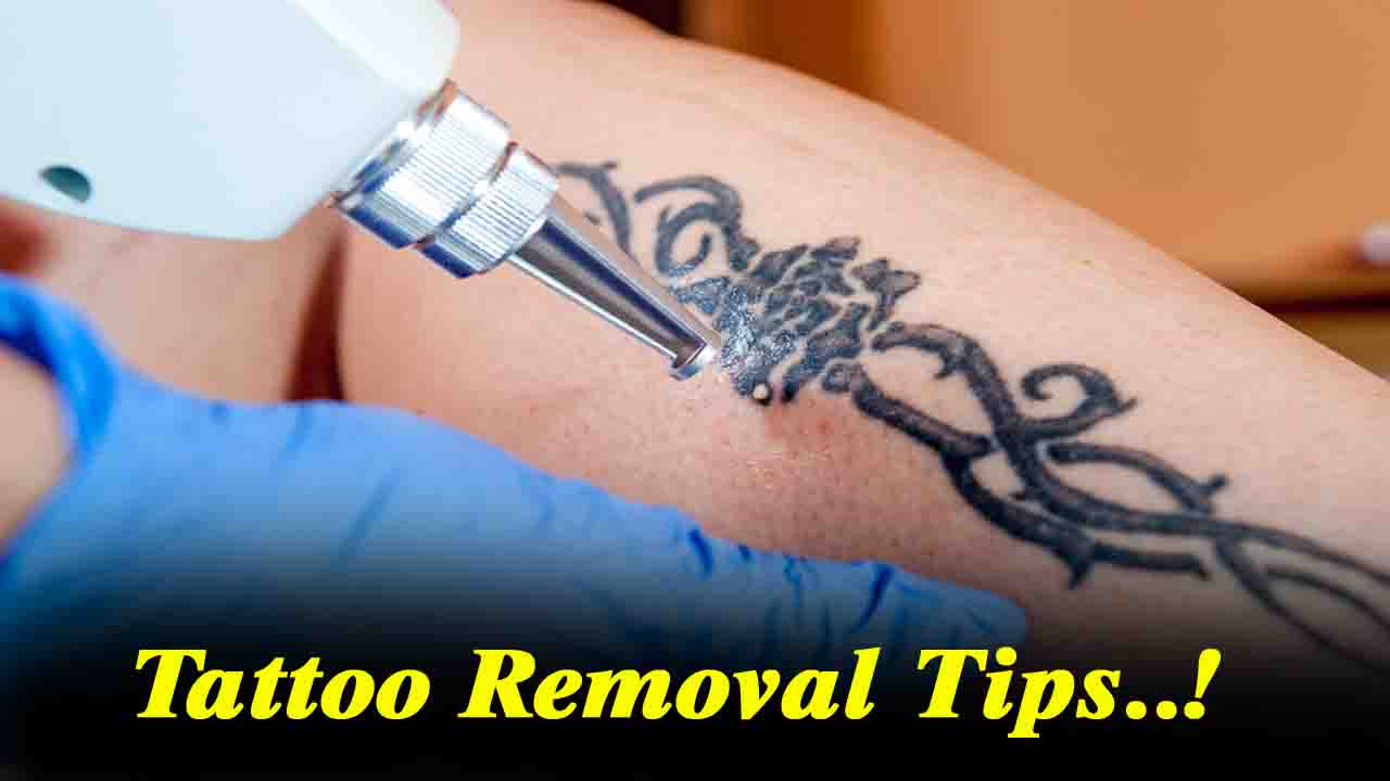 Tattoo Removal Tips: स्किन एक्सपर्ट से जानिए, कैसे पा सकते है टैटू से छुटकारा?