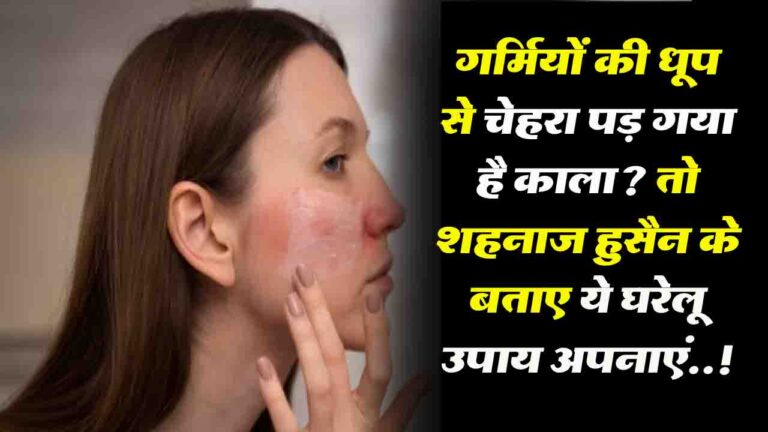 Face Turned Dark: गर्मियों की धूप से चेहरा पड़ गया है काला? तो शहनाज़ हुसैन के बताए ये घरेलू उपाय अपनाएं..!