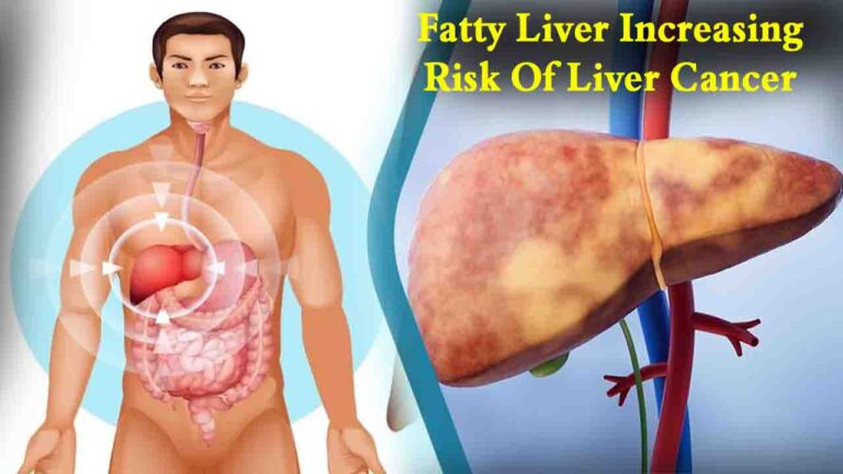 Fatty Liver: फैटी लिवर से बढ़ रहा है लिवर कैंसर का खतरा, समय रहते अपनाएं ये आसान उपाय