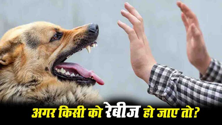 कुत्ते का काटना बन सकता है जानलेवा, जानिए Rabies से कैसे बचें?