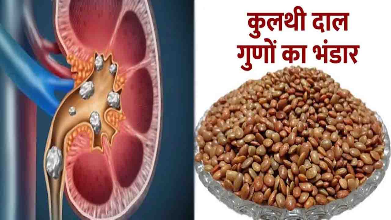 Horse Gram Benefits: किडनी स्टोन से लेकर वजन घटाने तक, सेहत के लिए बेहद फायदेमंद है कुल्थी की दाल