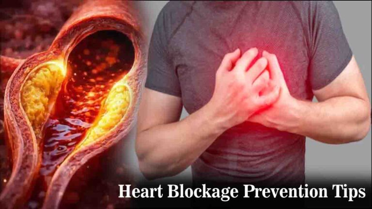Heart Blockage Prevention Tips: बदलती जीवनशैली और खान-पान ने बढ़ाया हृदय रोगों का जोखिम, बचाव के लिए जाने क्या है विशेषज्ञों की सलाह