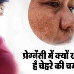Pregnancy Skin Care Tips: प्रेग्नेंसी में क्यों खो जाती है चेहरे की चमक? एक्सपर्ट से जानें स्किन डलनेस के मुख्य कारण और बचाव के असरदार उपाय