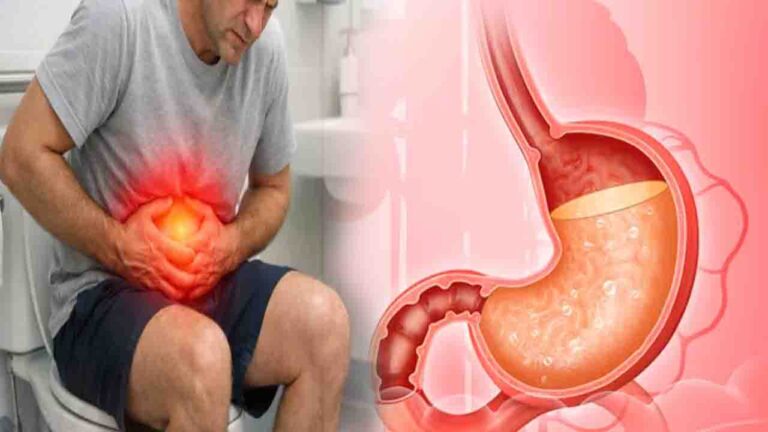 HOME 3 Health Tips: एसिडिटी और कब्ज - गर्मियों में पेट का ये हाल क्यों हो रहा है? डॉक्टर ने बताई असली वजह..