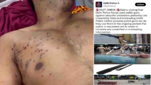Delhi Police Pellet Gun Claim: CJP प्रदर्शनकारियों पर में दिल्ली पुलिस ने चलाईं पैलेट गन? पुलिस ने किया खारिज
