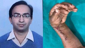AIIMS Bilaspur Hand Surgery: मशीन में कटकर लगभग अलग हो चुका था हाथ, AIIMS बिलासपुर के डॉक्टरों ने 7 घंटे की सर्जरी से रचा इतिहास!