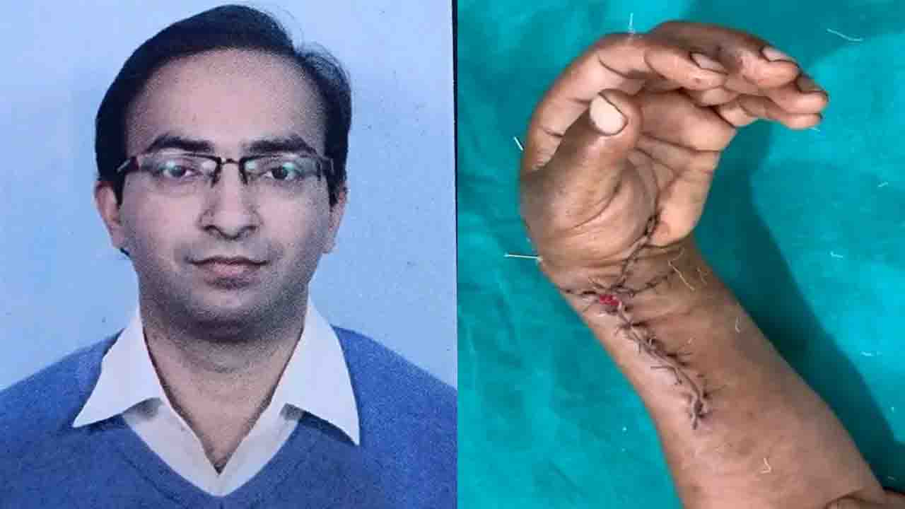 AIIMS Bilaspur Hand Surgery: मशीन में कटकर लगभग अलग हो चुका था हाथ, AIIMS बिलासपुर के डॉक्टरों ने 7 घंटे की सर्जरी से रचा इतिहास!