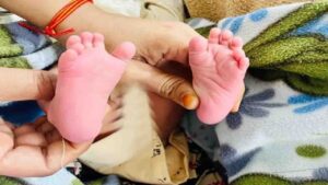 Polydactyly Baby Born in Himachal: "हाथों-पैरों में 6-6 उंगलियां", पालमपुर अस्पताल में जन्मे 'अनोखे' बच्चे को देख परिजन और डॉक्टर भी हैरान,