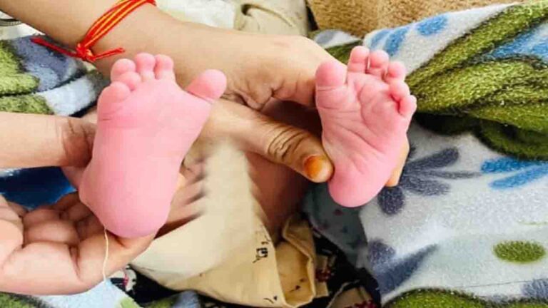 Polydactyly Baby Born in Himachal: "हाथों-पैरों में 6-6 उंगलियां", पालमपुर अस्पताल में जन्मे 'अनोखे' बच्चे को देख परिजन और डॉक्टर भी हैरान,